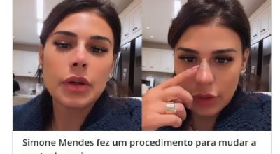 cantora simone mendes nariz